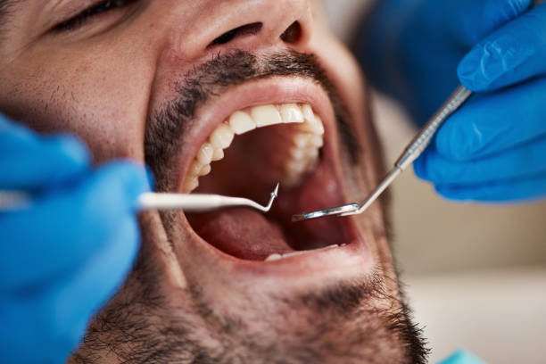 Best Emergency Treatment for Jaw Pain or Injury in Memphis, FL