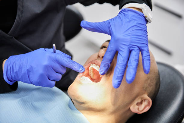 Best Emergency Wisdom Tooth Extraction in Memphis, FL